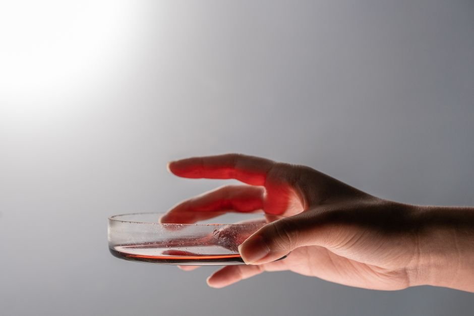 Sintomas da doença falciforme vão além da anemia, alerta campanha