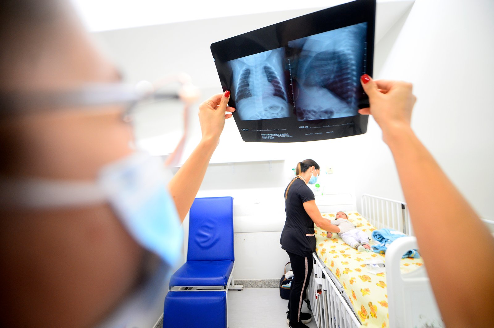 SES-DF alerta para cuidados redobrados com crianças e idosos em doenças respiratórias