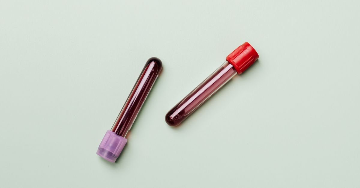 Blood samples in test tubes on a light background, ideal for medical and laboratory themes.