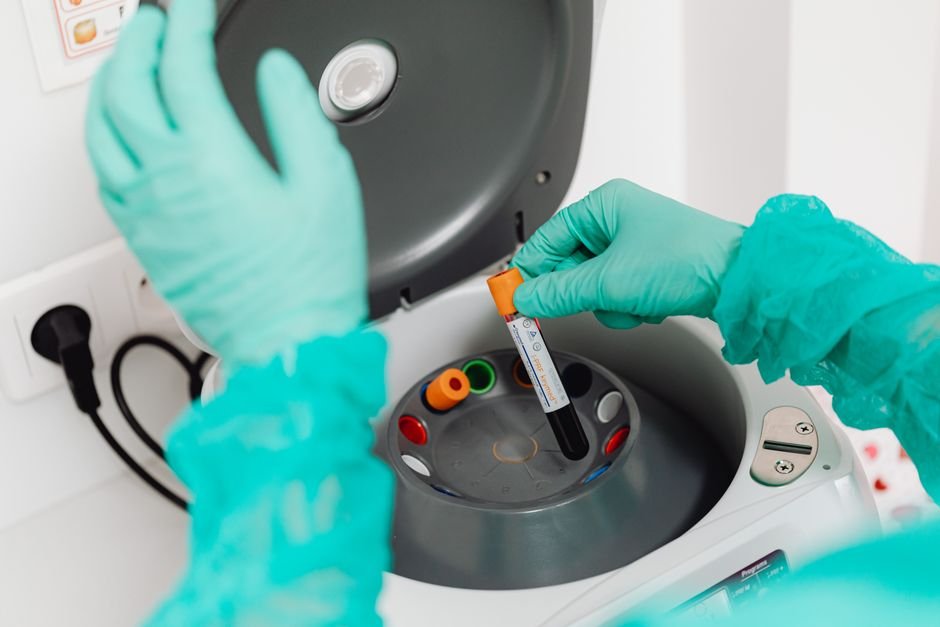 PL 5478/25 ganhou urgência na Câmara e quer padronizar exames laboratoriais na rede pública, reduzindo a esper