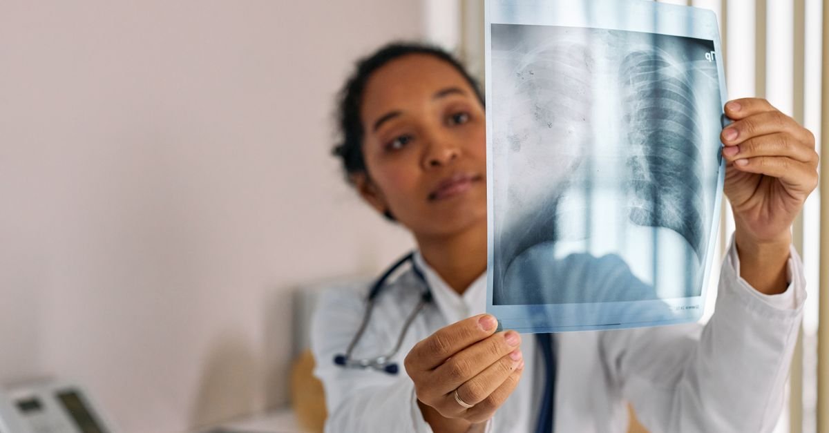 Médica observa uma radiografia de tórax contra a luz em consultório