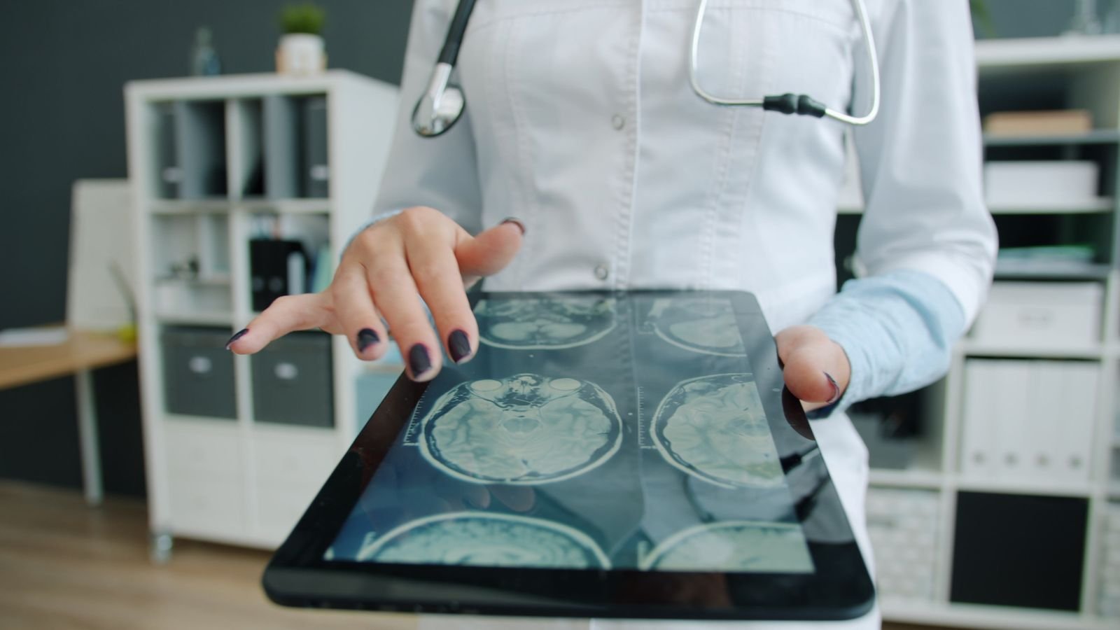 Profissional de jaleco usa tablet que exibe exames de ressonância do cérebro (foto ilustrativa)