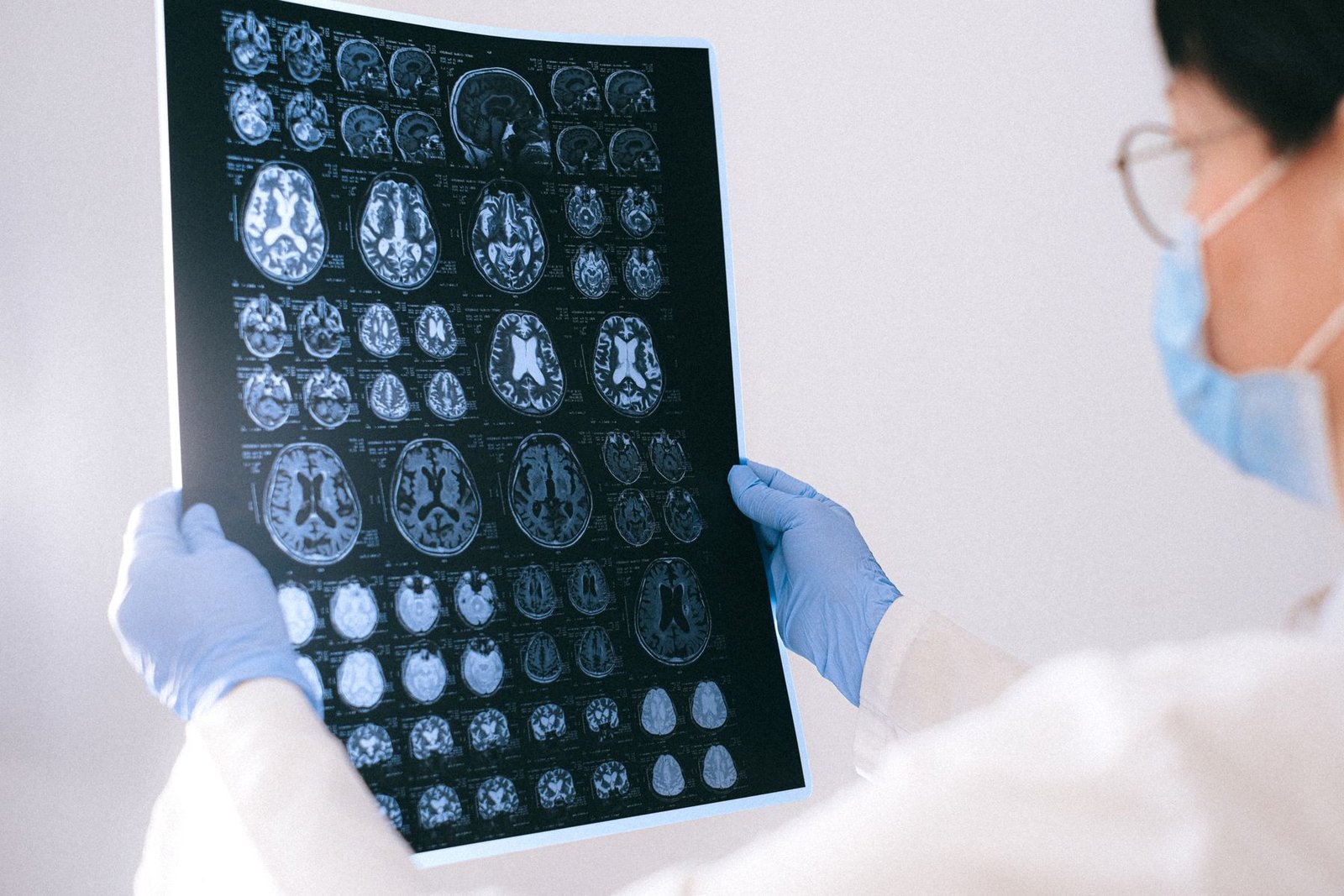 Profissional de saúde de máscara e luvas examina imagens de ressonância magnética do cérebro